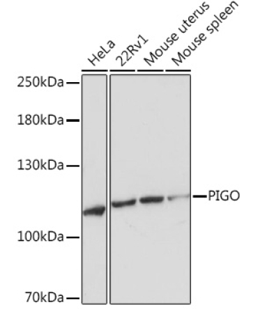 PIGO Rabbit Polyclonal Antibody