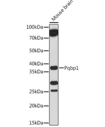 Pqbp1 Rabbit Polyclonal Antibody