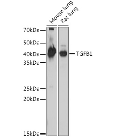 TGF beta 1 Rabbit Polyclonal Antibody