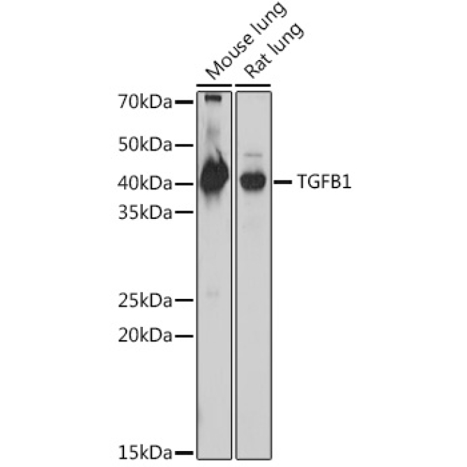 TGF beta 1 Rabbit Polyclonal Antibody