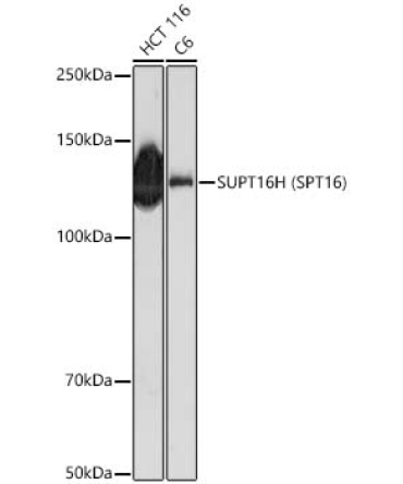 SUPT16H (SPT16) Rabbit Polyclonal Antibody