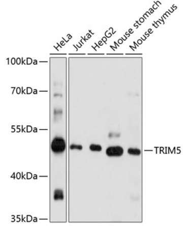 TRIM5 Rabbit Polyclonal Antibody