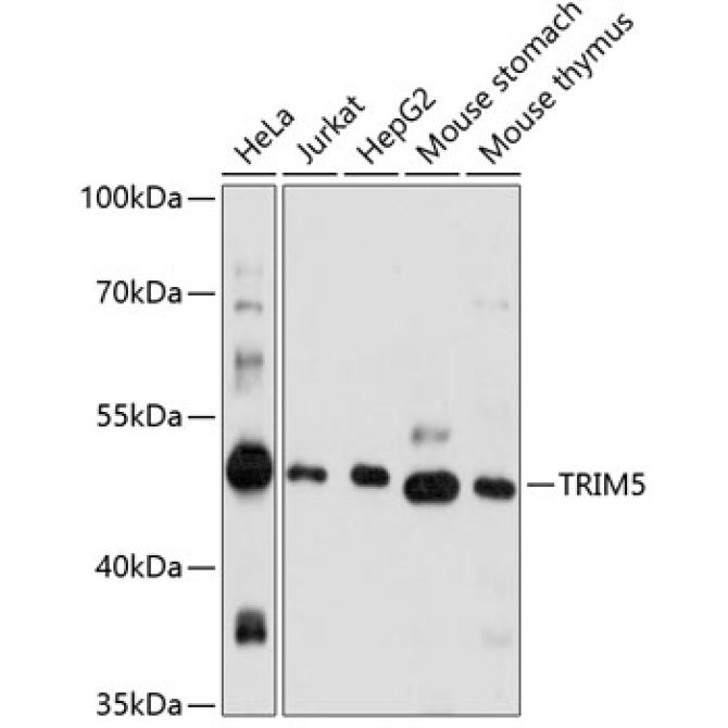 TRIM5 Rabbit Polyclonal Antibody
