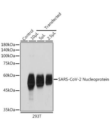 SARS-CoV-2 Nucleoprotein Rabbit Polyclonal Antibody