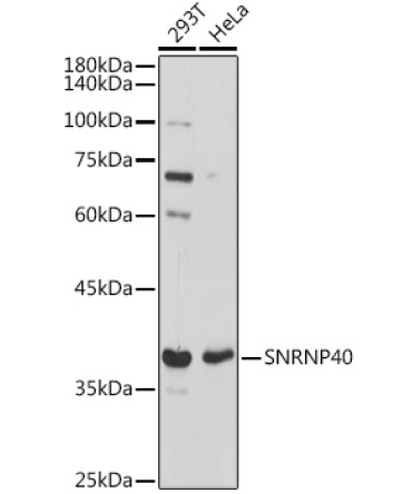 SNRNP40 Rabbit Polyclonal Antibody