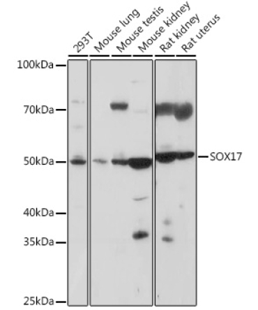 SOX17 Rabbit Polyclonal Antibody