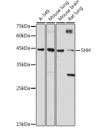 SHH Rabbit Polyclonal Antibody