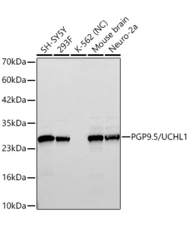 PGP9.5/UCHL1 Rabbit Monoclonal Antibody