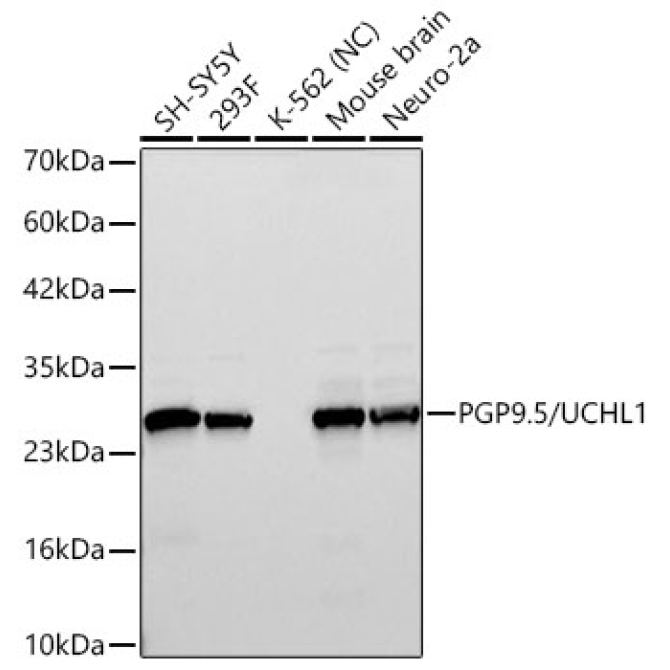 PGP9.5/UCHL1 Rabbit Monoclonal Antibody