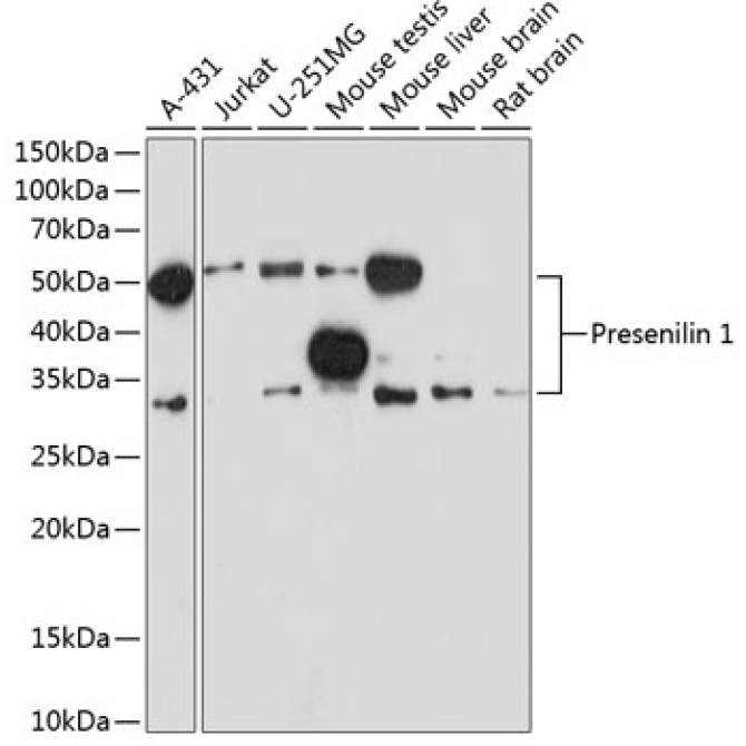 Presenilin 1 Rabbit Monoclonal Antibody