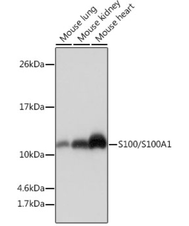 S100/S100A1 Rabbit Monoclonal Antibody