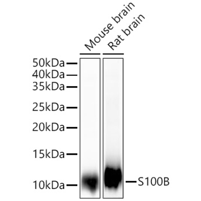 S100B Rabbit Monoclonal Antibody