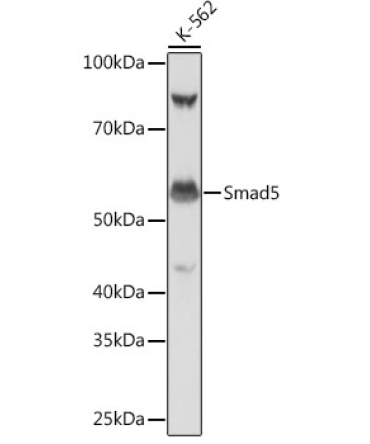 Smad5 Rabbit Monoclonal Antibody