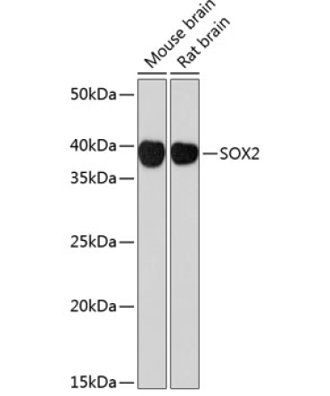 SOX2 Rabbit Monoclonal Antibody