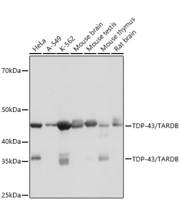 TDP-43/TARDBP Rabbit Monoclonal Antibody