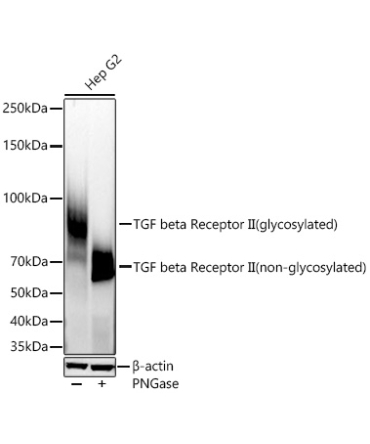 TGF beta Receptor II Rabbit Monoclonal Antibody