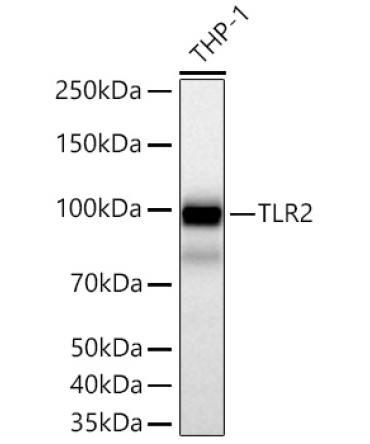 TLR2 Rabbit Monoclonal Antibody