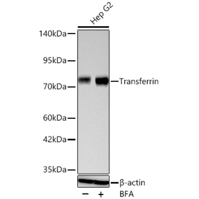 Transferrin Rabbit Monoclonal Antibody