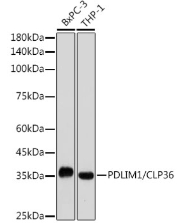 PDLIM1/CLP36 Rabbit Monoclonal Antibody
