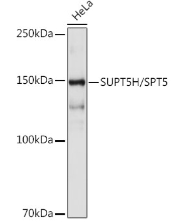 SUPT5H/SPT5 Rabbit Monoclonal Antibody