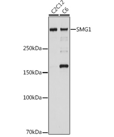 SMG1 Rabbit Monoclonal Antibody