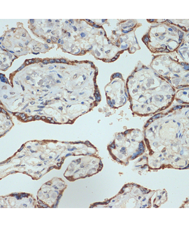 Placental lactogen (CSH1) Rabbit Monoclonal Antibody
