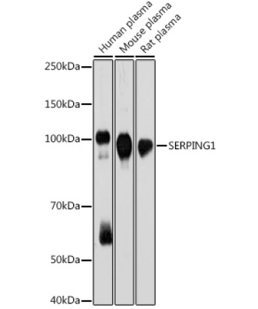 SERPING1 Rabbit Monoclonal Antibody