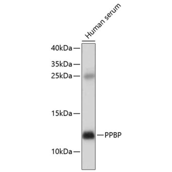 PPBP Rabbit Polyclonal Antibody