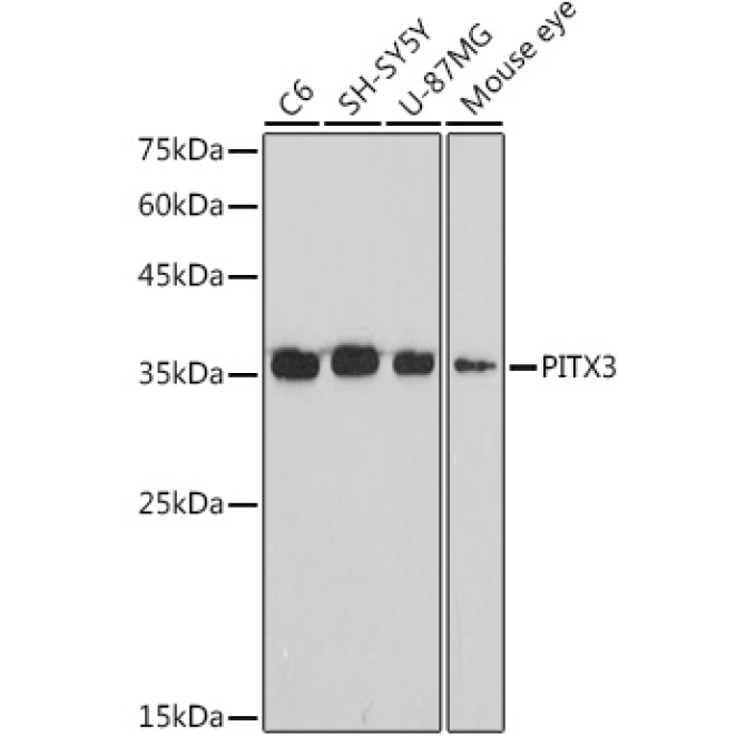 PITX3 Rabbit Monoclonal Antibody