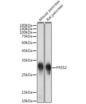 PRSS2 Rabbit Monoclonal Antibody
