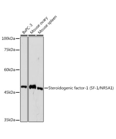 Steroidogenic factor-1 (SF-1/NR5A1) Rabbit Monoclonal Antibody