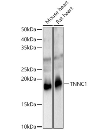 TNNC1 Rabbit Polyclonal Antibody