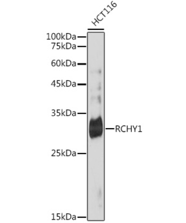 RCHY1 Rabbit Monoclonal Antibody