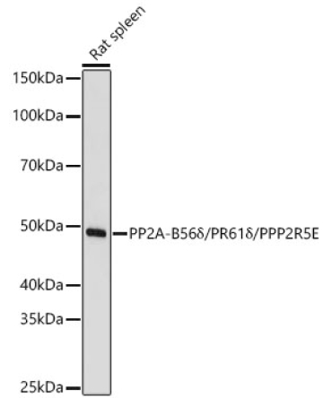 PP2A-B56Delta/PR61Delta/PPP2R5E Rabbit Polyclonal Antibody