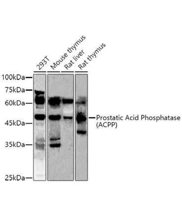 Prostatic Acid Phosphatase (ACPP) Rabbit Polyclonal Antibody