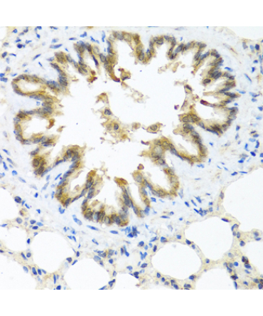 S100A7/Psoriasin Rabbit Polyclonal Antibody