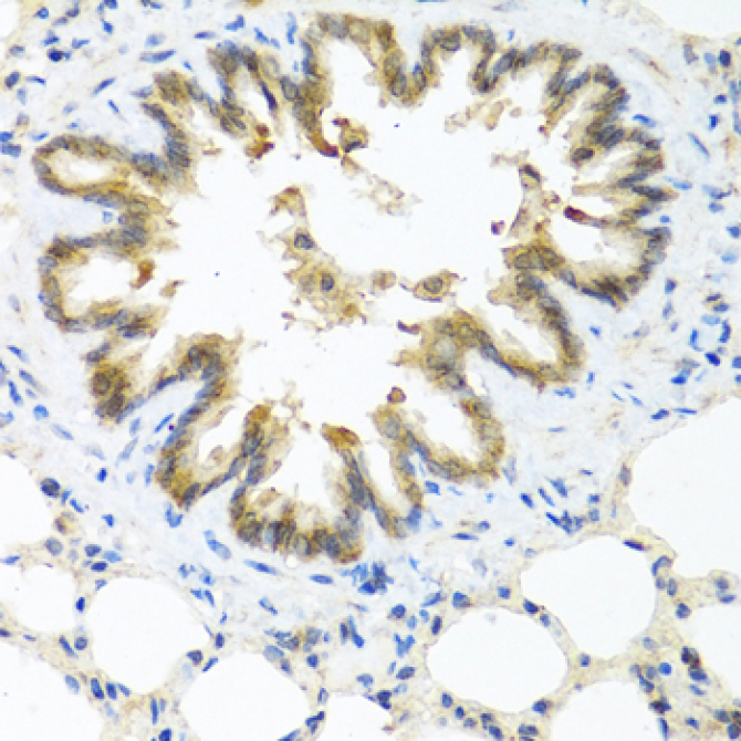 S100A7/Psoriasin Rabbit Polyclonal Antibody