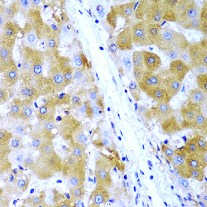 TIRAP Rabbit Polyclonal Antibody