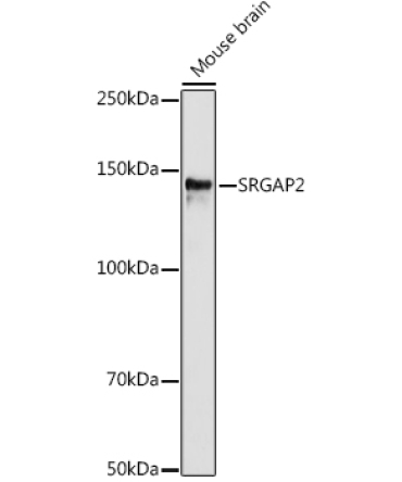 SRGAP2 Rabbit Polyclonal Antibody
