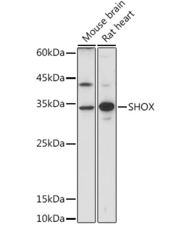 SHOX Rabbit Polyclonal Antibody