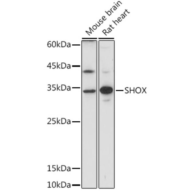 SHOX Rabbit Polyclonal Antibody