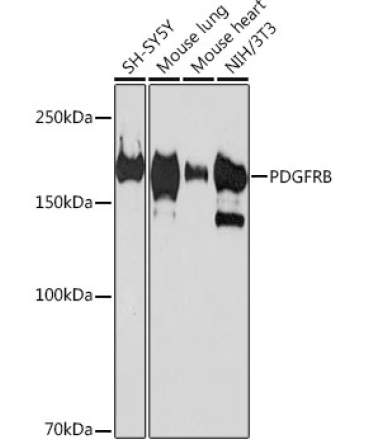 PDGFRB Rabbit Monoclonal Antibody
