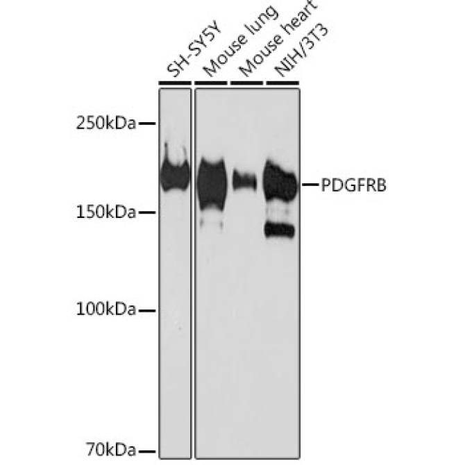 PDGFRB Rabbit Monoclonal Antibody