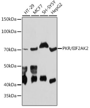PKR/EIF2AK2 Rabbit Monoclonal Antibody