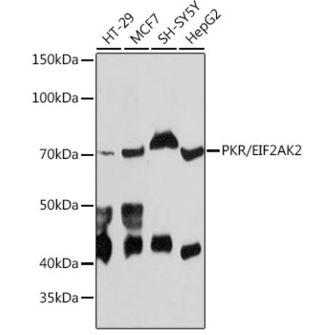 PKR/EIF2AK2 Rabbit Monoclonal Antibody