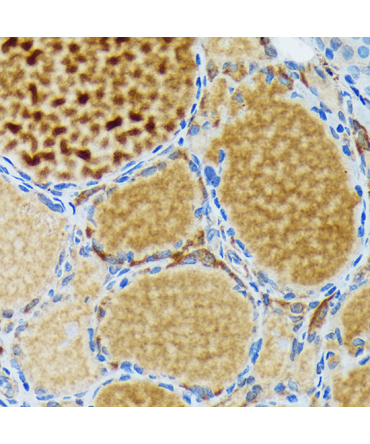 Thyroid Peroxidase Rabbit Monoclonal Antibody