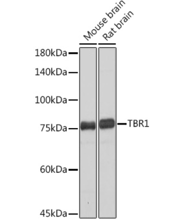 TBR1 Rabbit Monoclonal Antibody