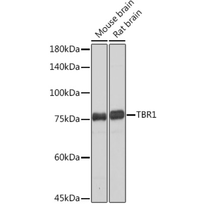 TBR1 Rabbit Monoclonal Antibody