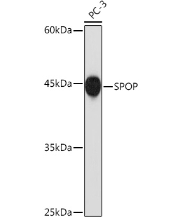 SPOP Rabbit Monoclonal Antibody