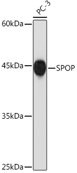 SPOP Rabbit Monoclonal Antibody